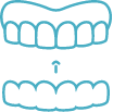 Invisalign® Braces